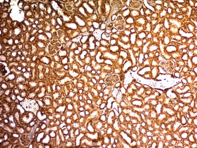 Formalin-fixed, paraffin embedded mouse kidney sections stained with 100 ul anti-Wilms Tumor 1 (clone WT1/857 + 6F-H2) at 1:50. HIER epitope retrieval prior to staining was performed in 10mM Citrate, pH 6.0.